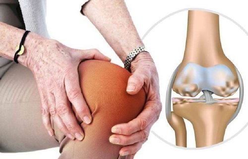 Tiêm chất nhờn vào khớp gối có tốt không? Có an toàn không? 3 Khô Khớp